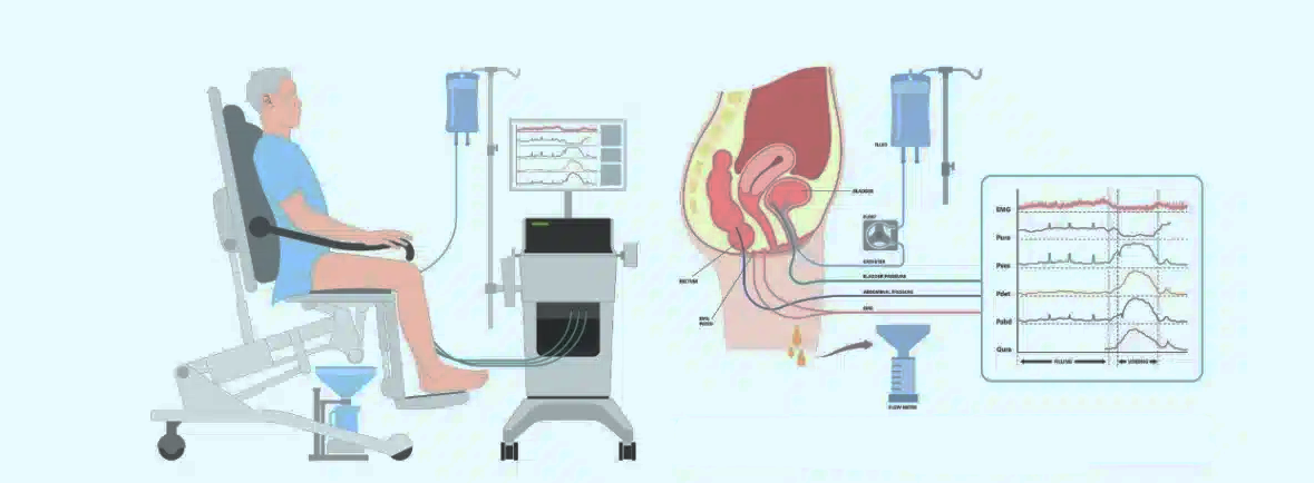 Que es la urodinamia?